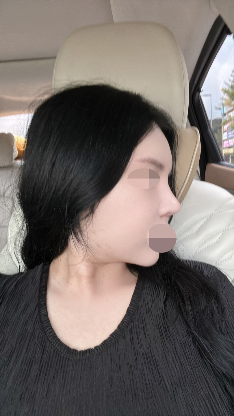 수술후기이미지