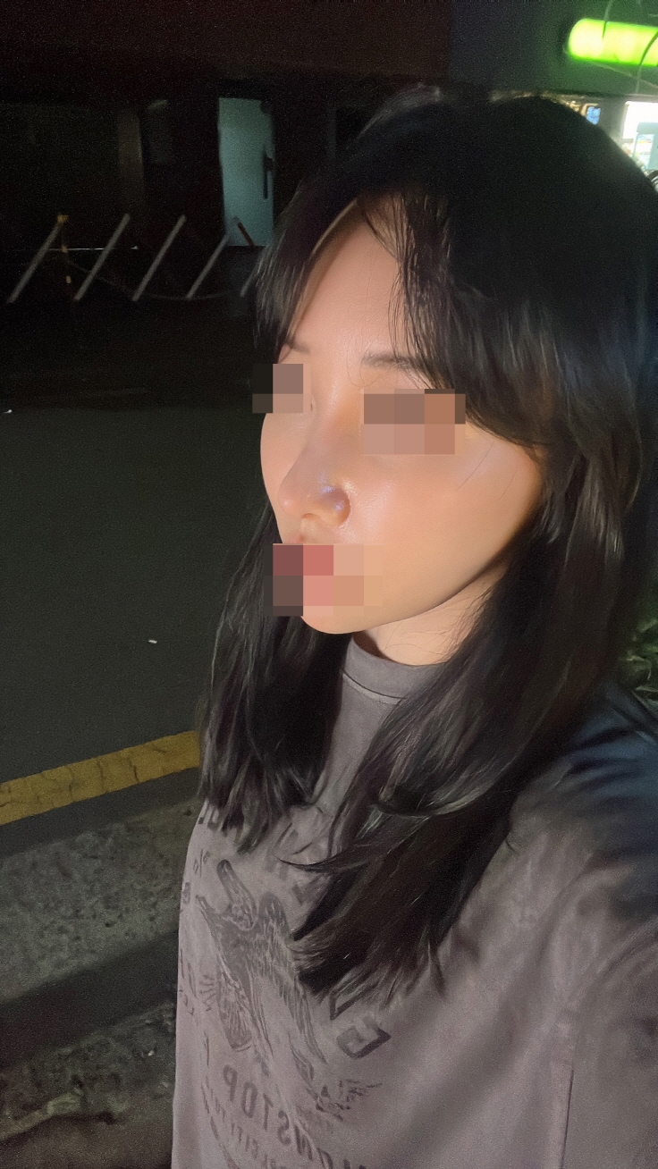 수술후기이미지