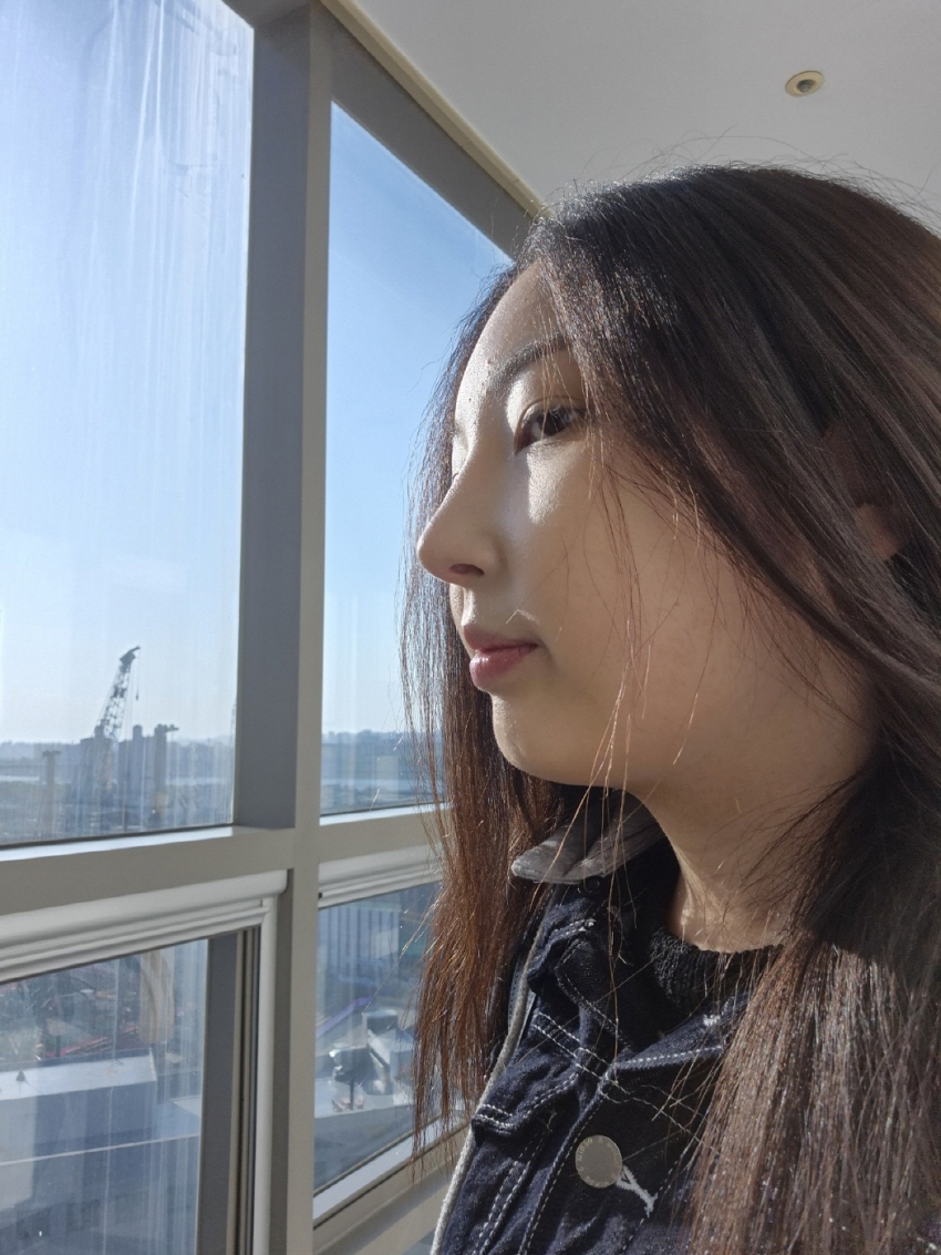 수술후기이미지