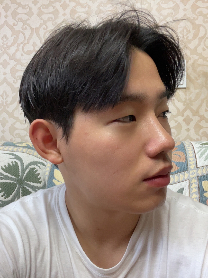 수술후기이미지