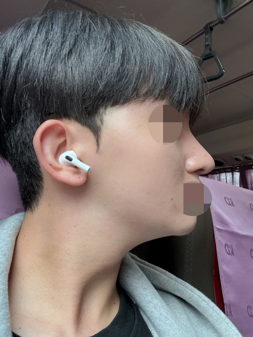 수술후기이미지