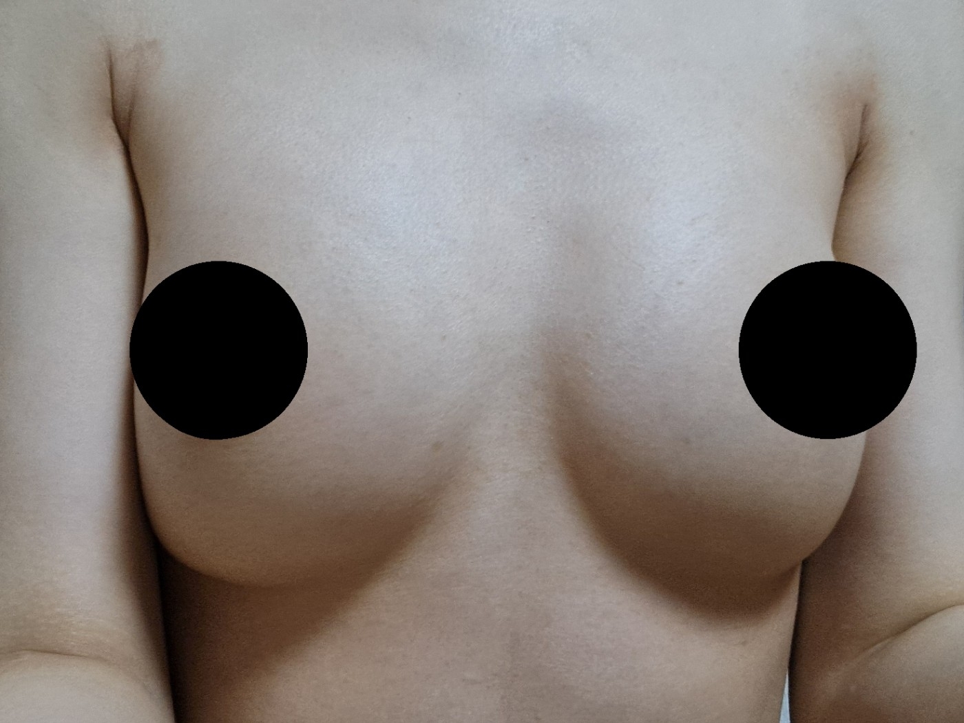 수술후기이미지