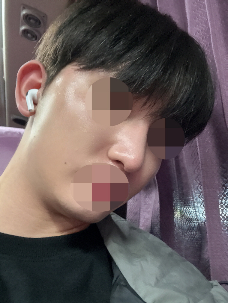 수술후기이미지