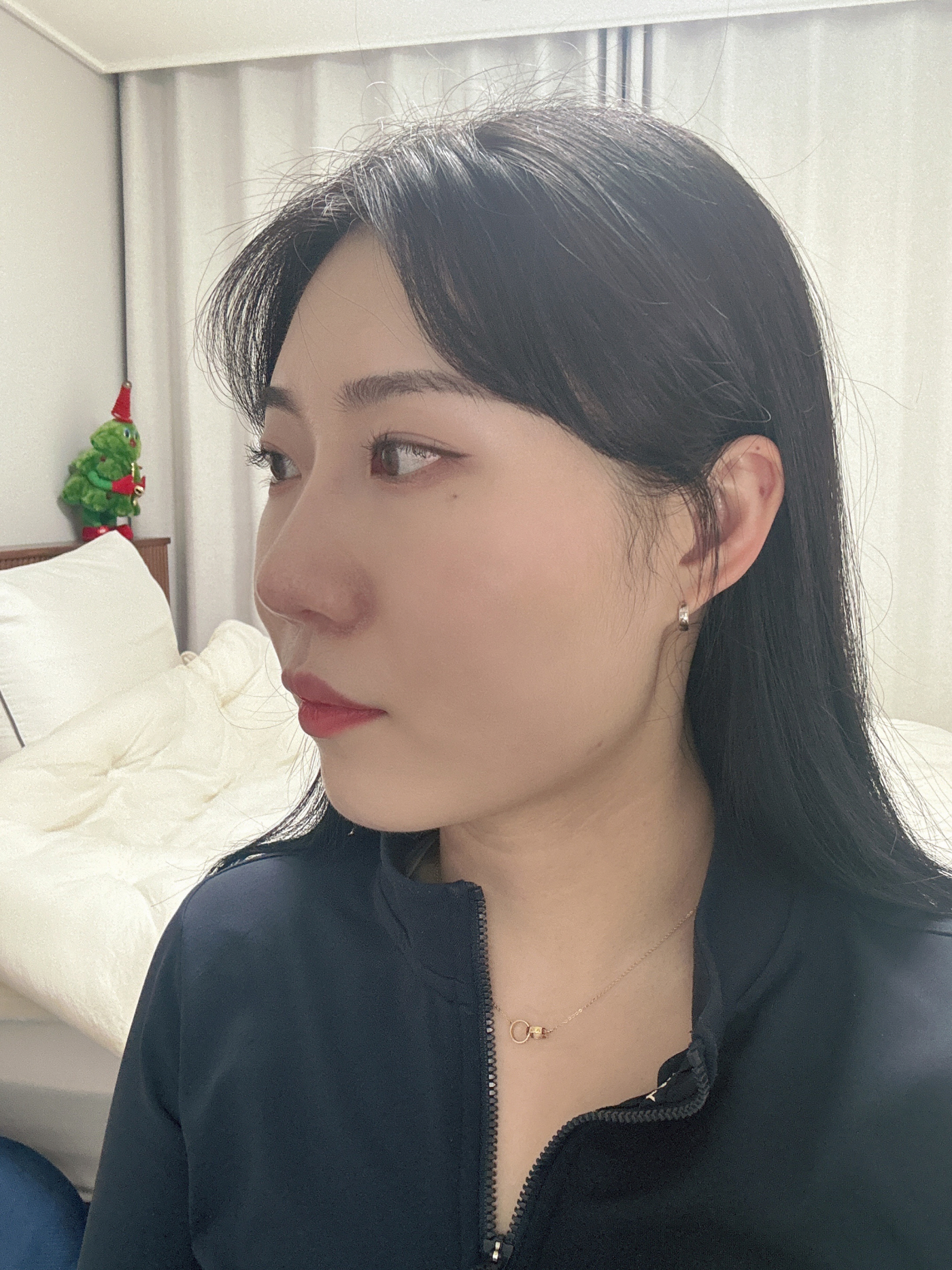 수술후기이미지