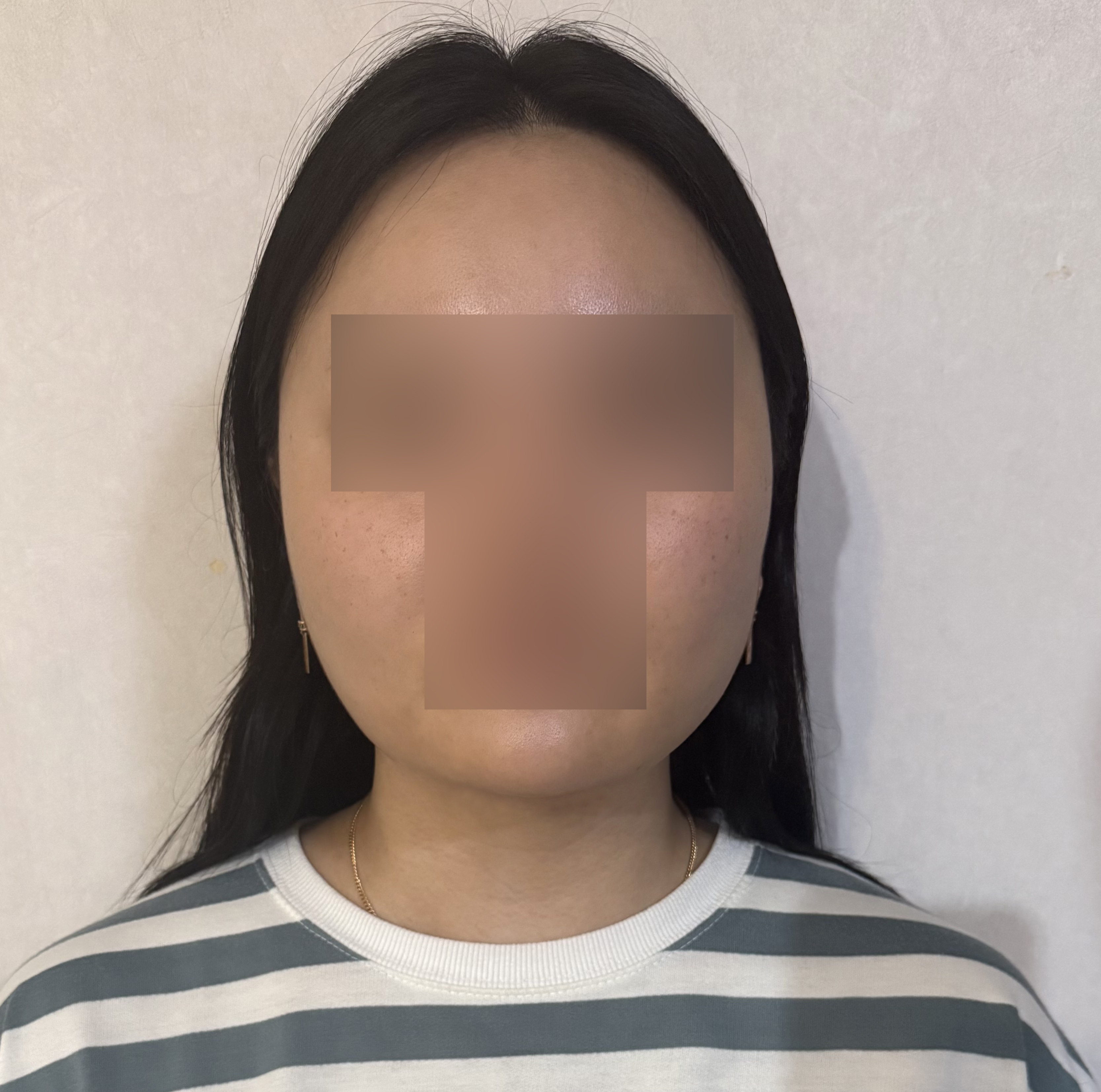 수술후기이미지