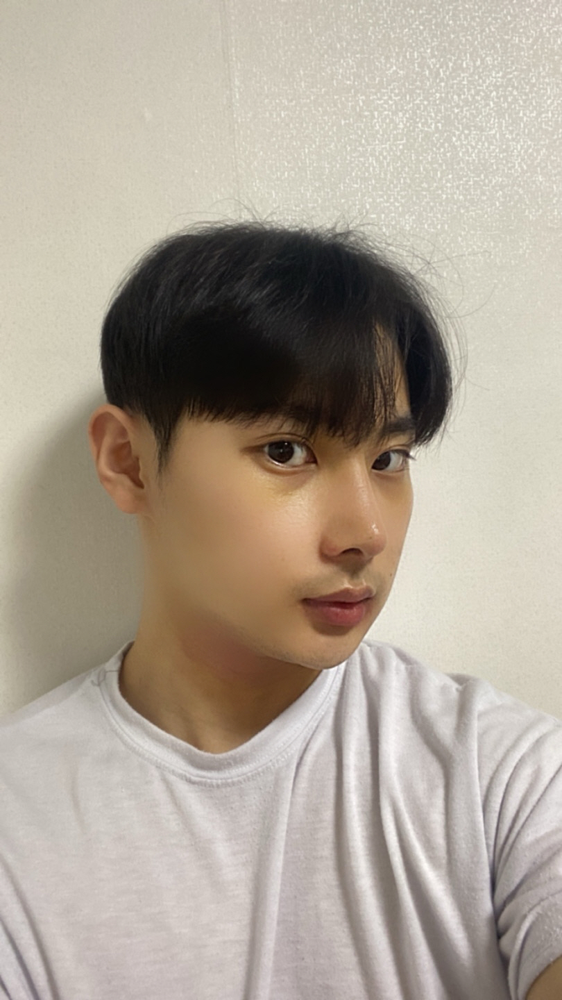 수술후기이미지