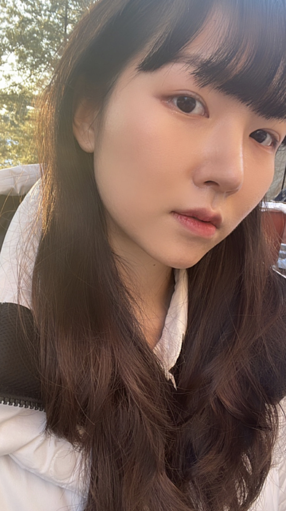 수술후기이미지