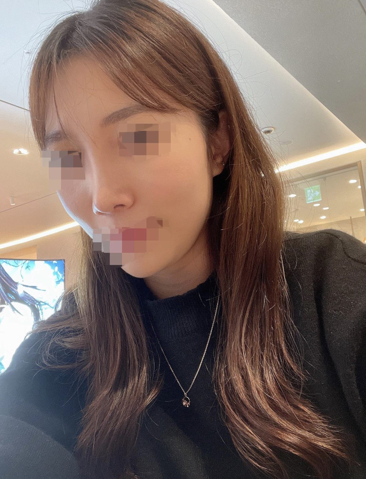 수술후기이미지