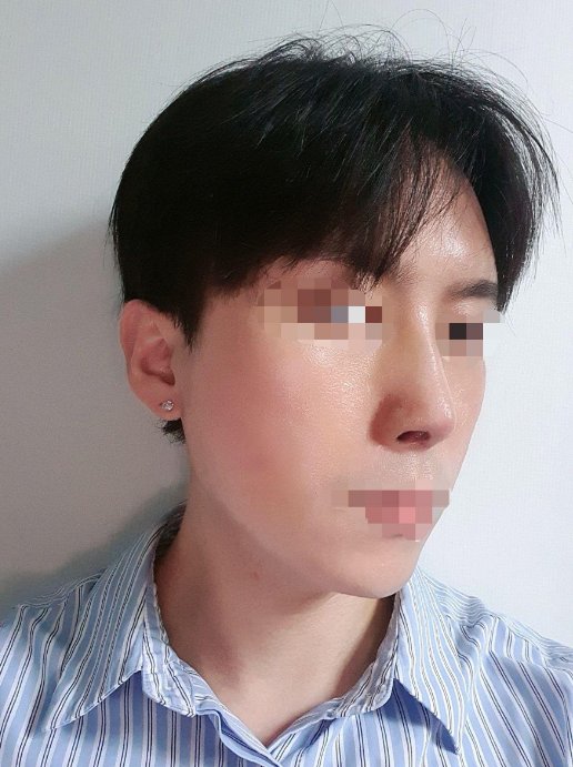 수술후기이미지