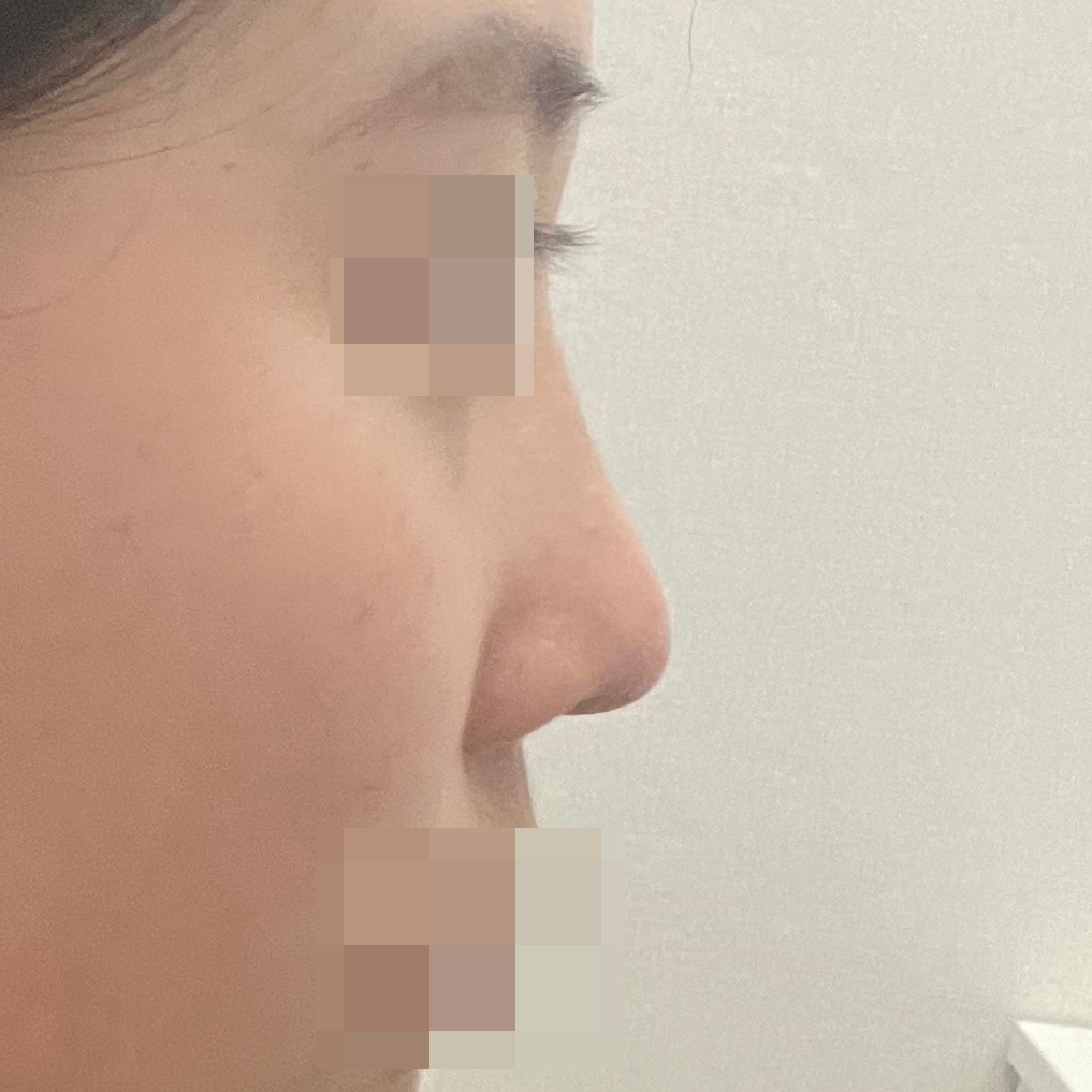 수술후기이미지