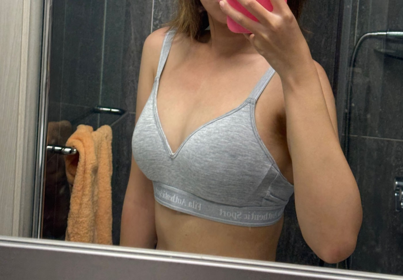 수술후기이미지