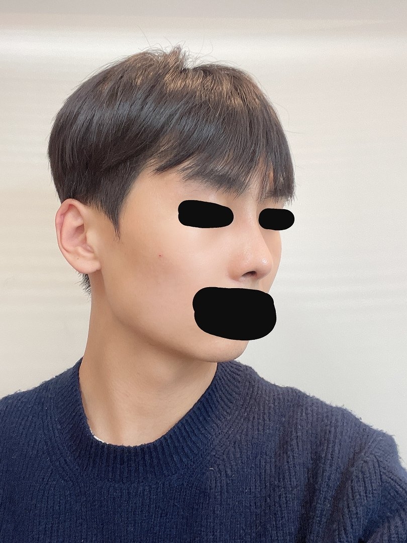 수술후기이미지