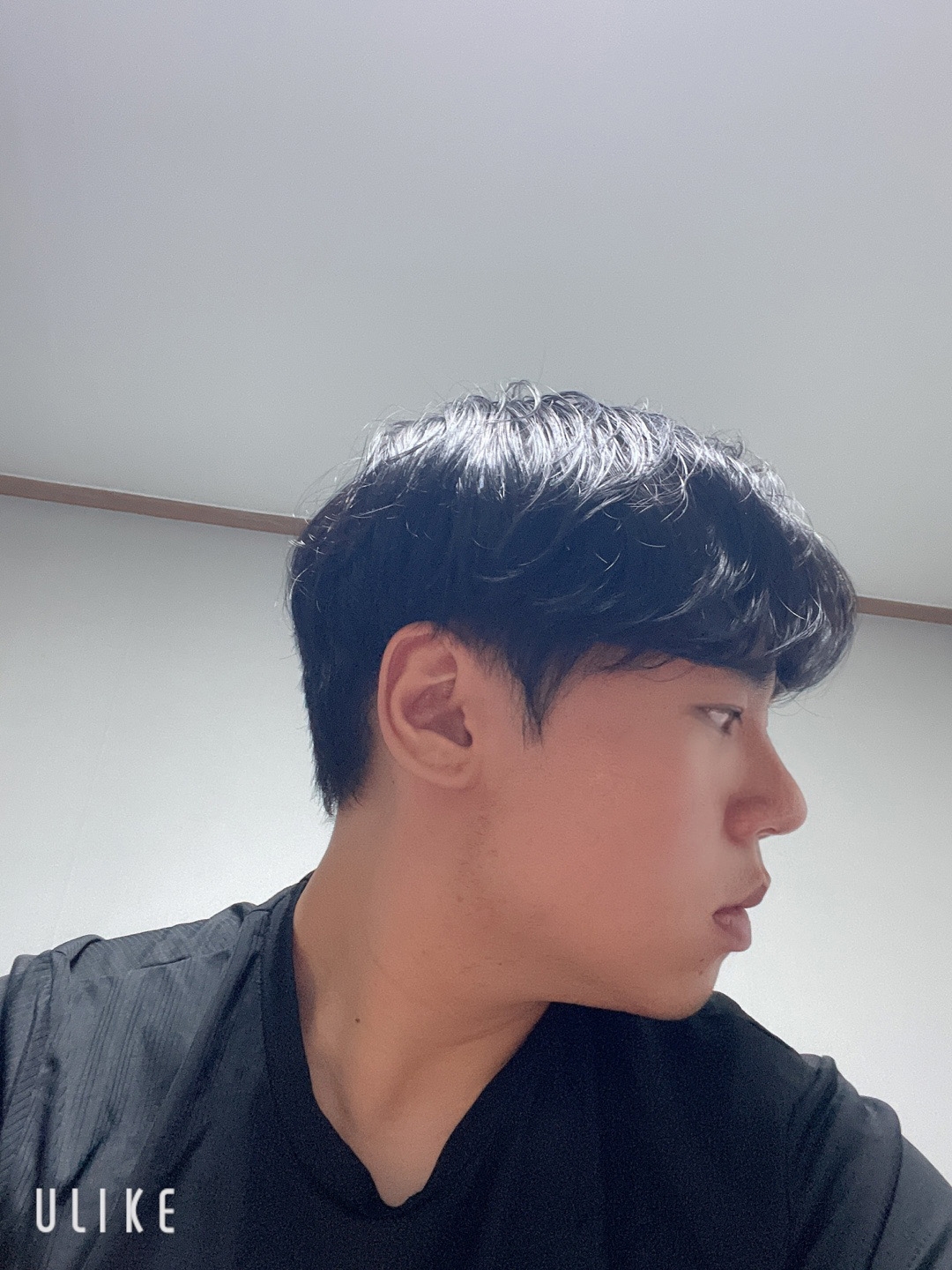 수술후기이미지