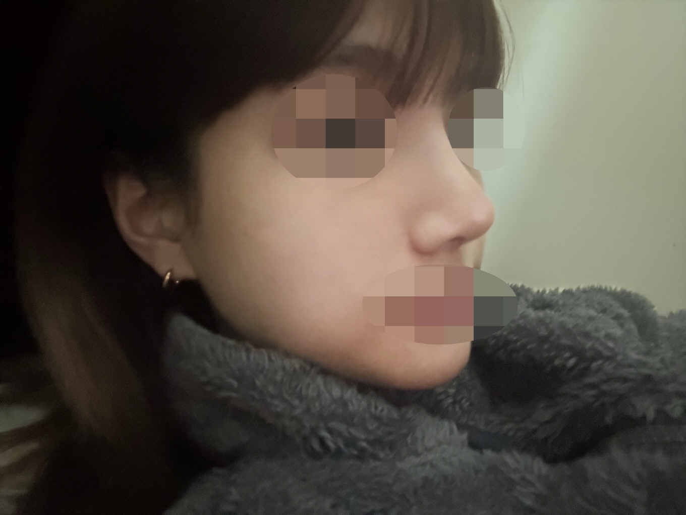 수술후기이미지