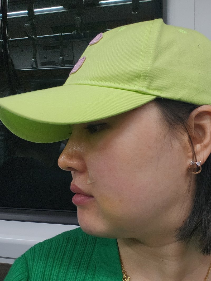 수술후기이미지