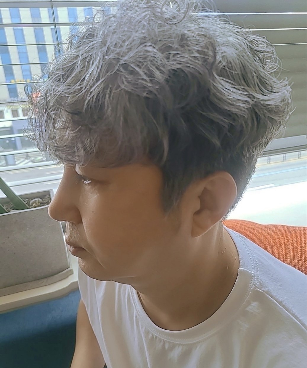 수술후기이미지