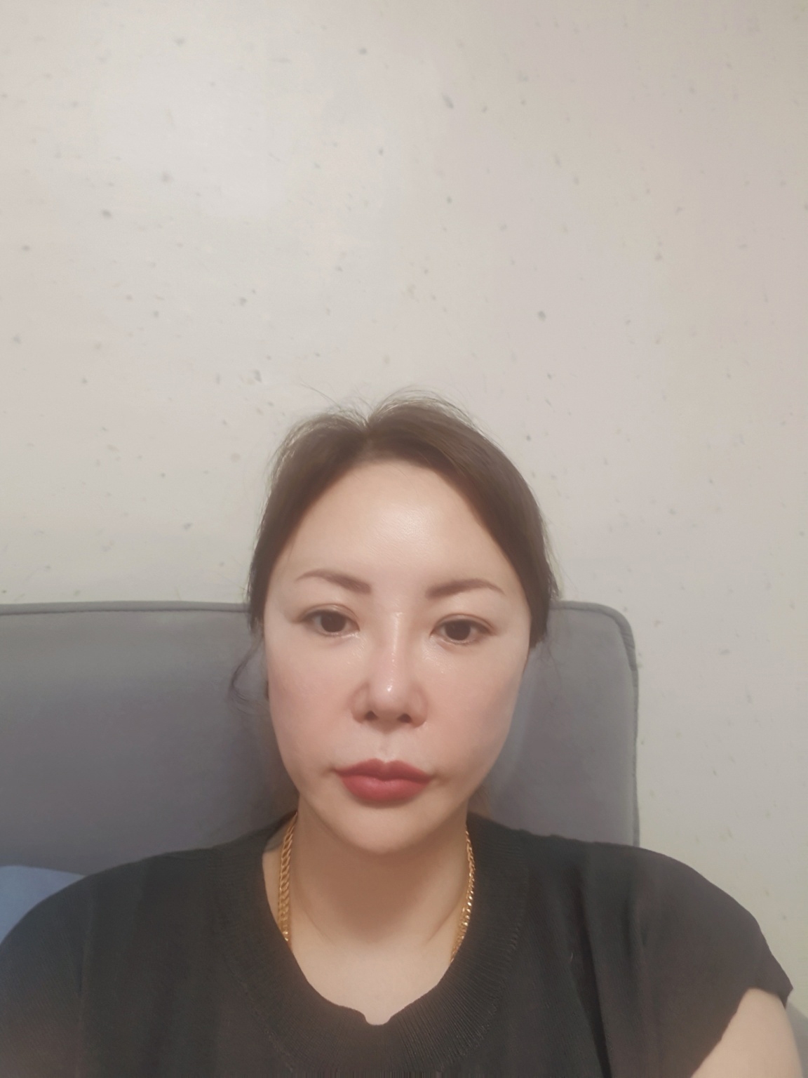 수술후기이미지