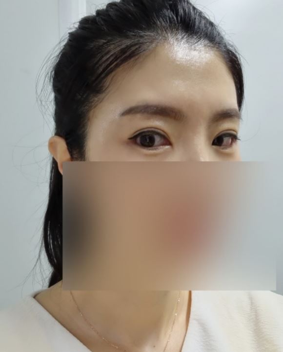 수술후기이미지