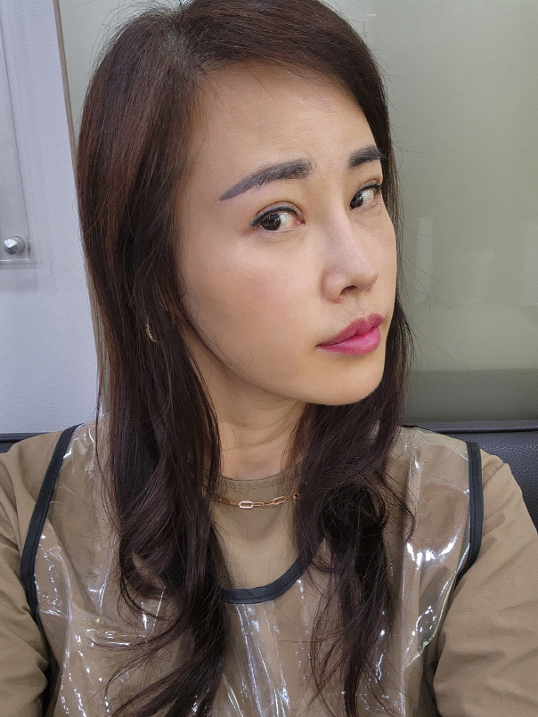 수술후기이미지