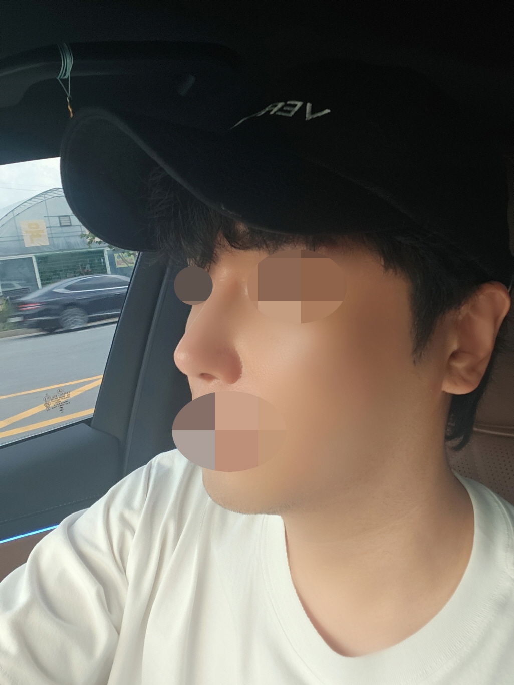 수술후기이미지