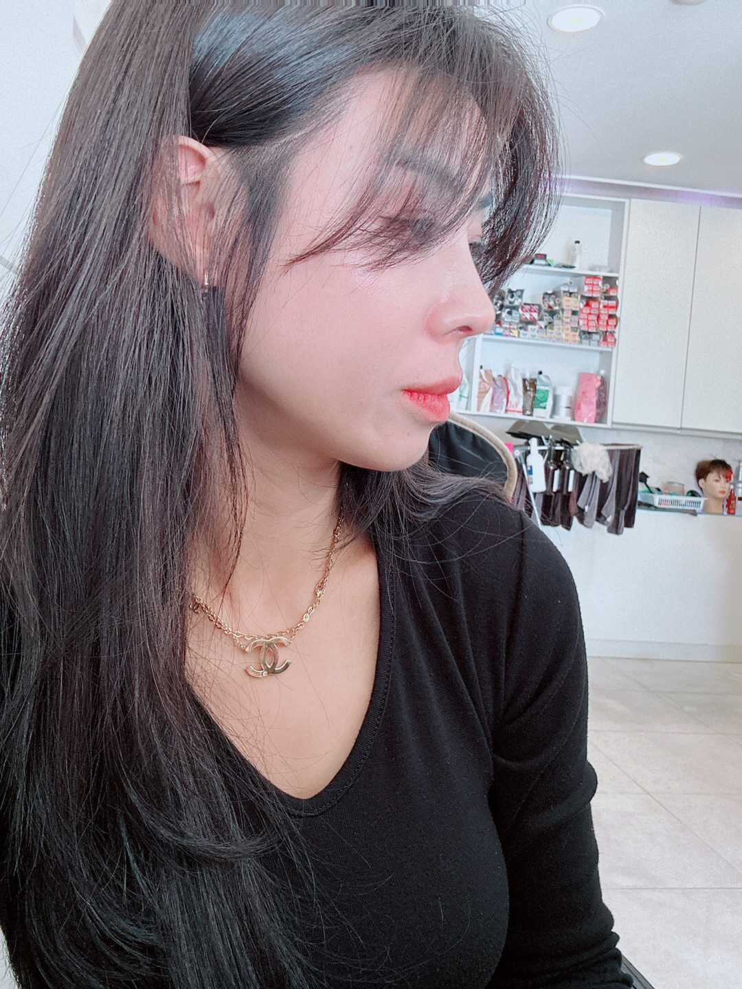 수술후기이미지