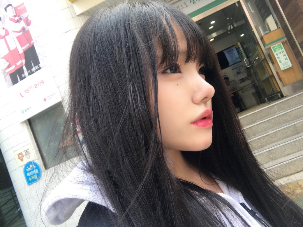 수술후기이미지