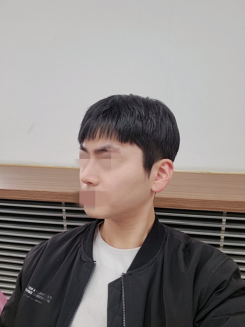 수술후기이미지