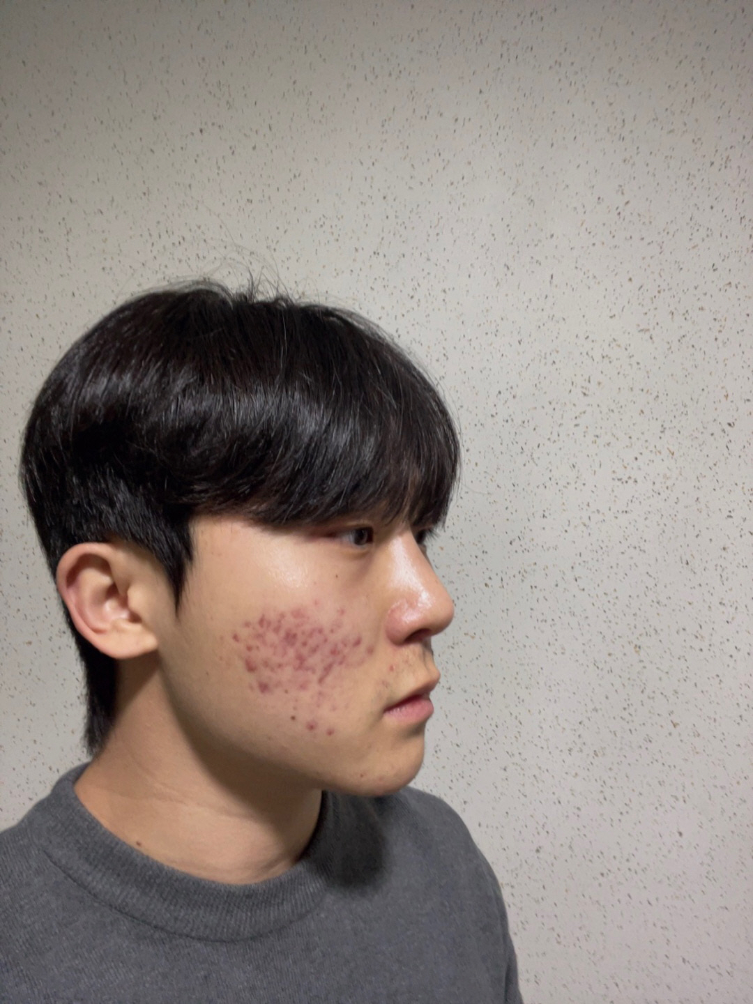 수술후기이미지