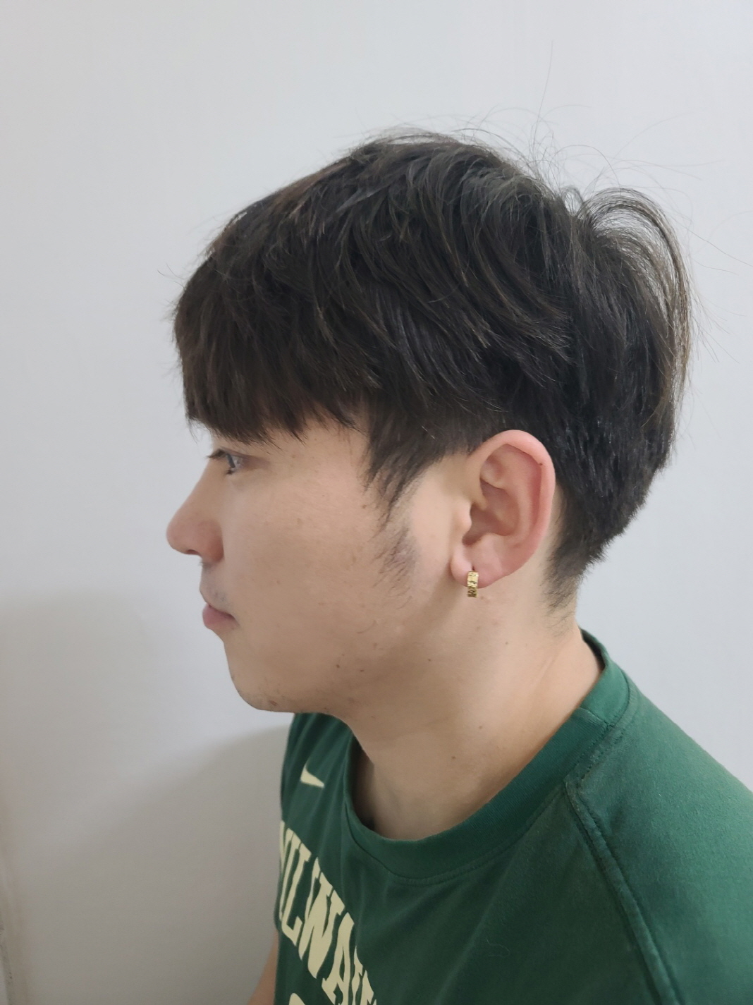 수술후기이미지