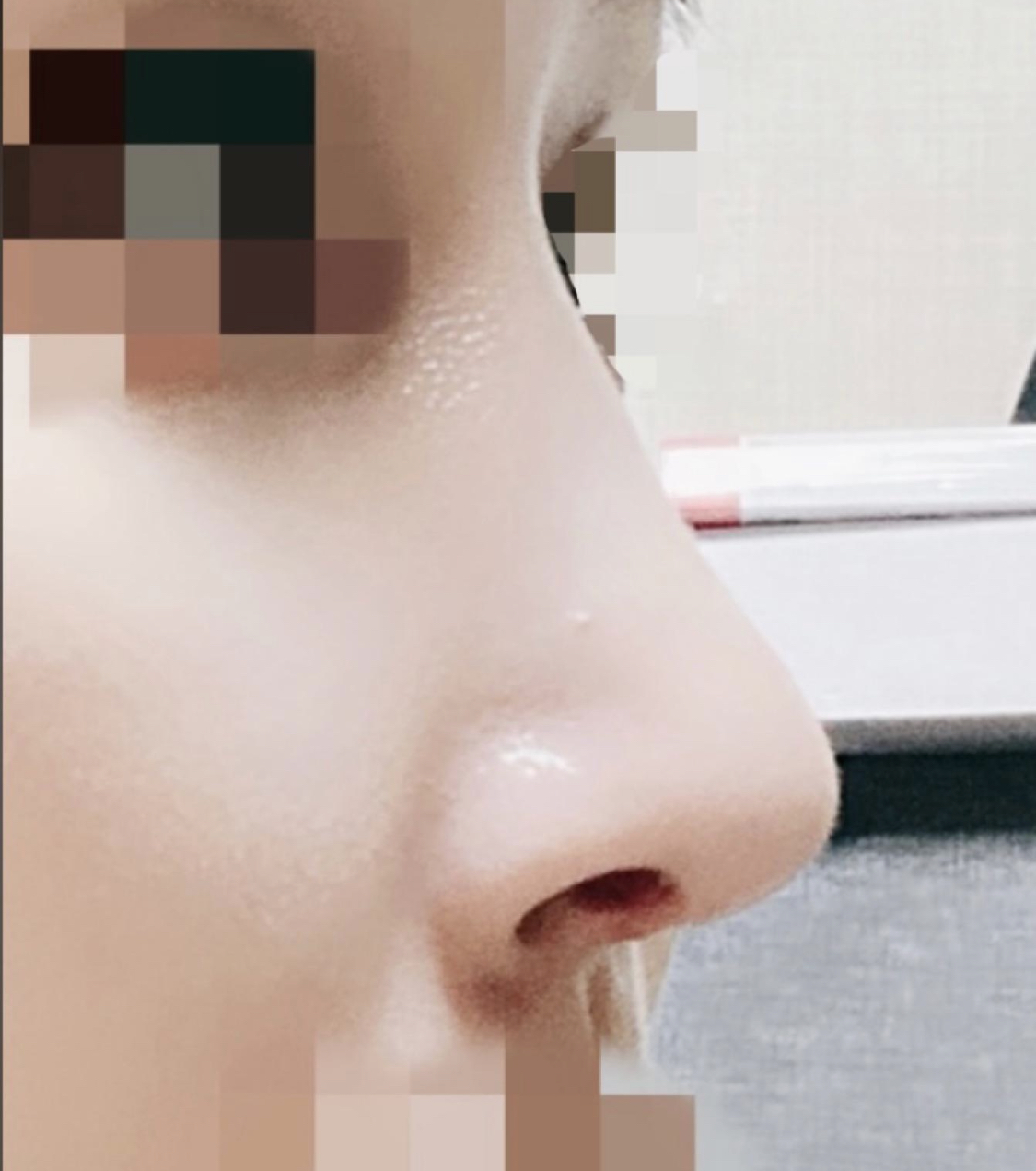 수술후기이미지