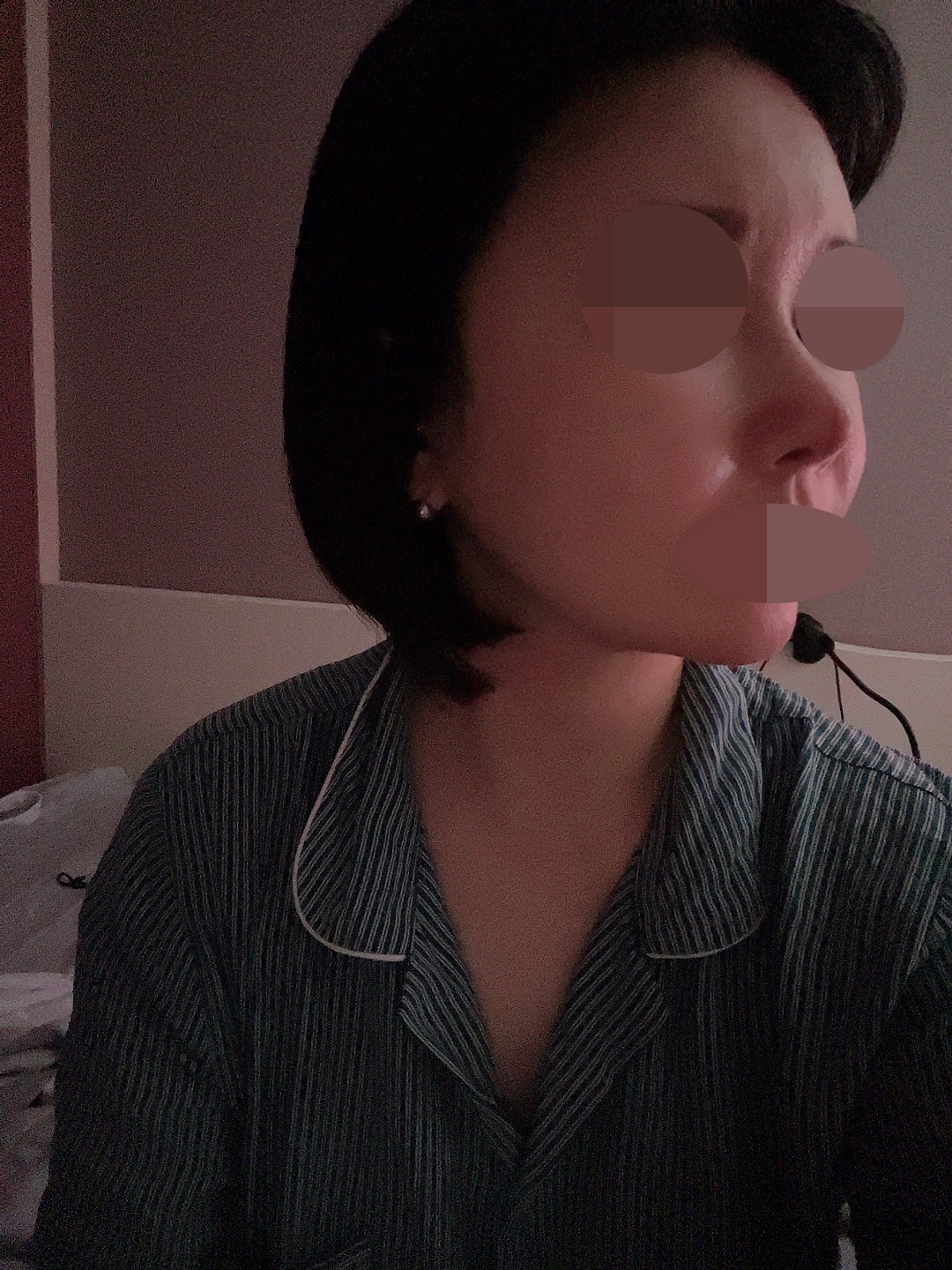 수술후기이미지