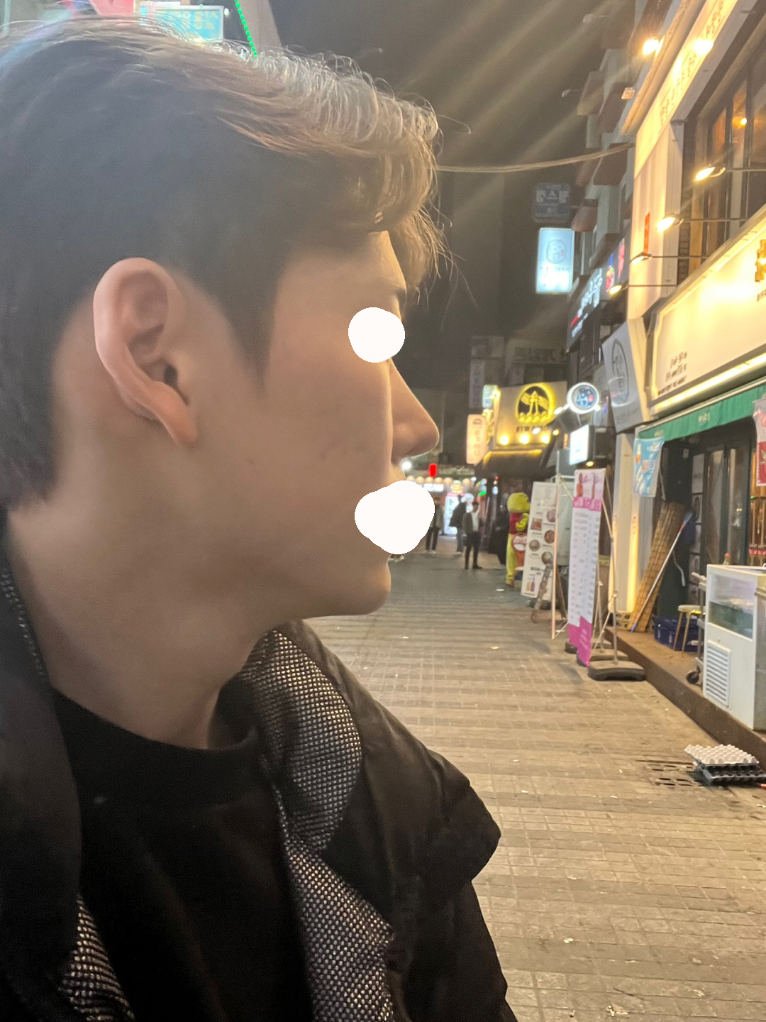 수술후기이미지