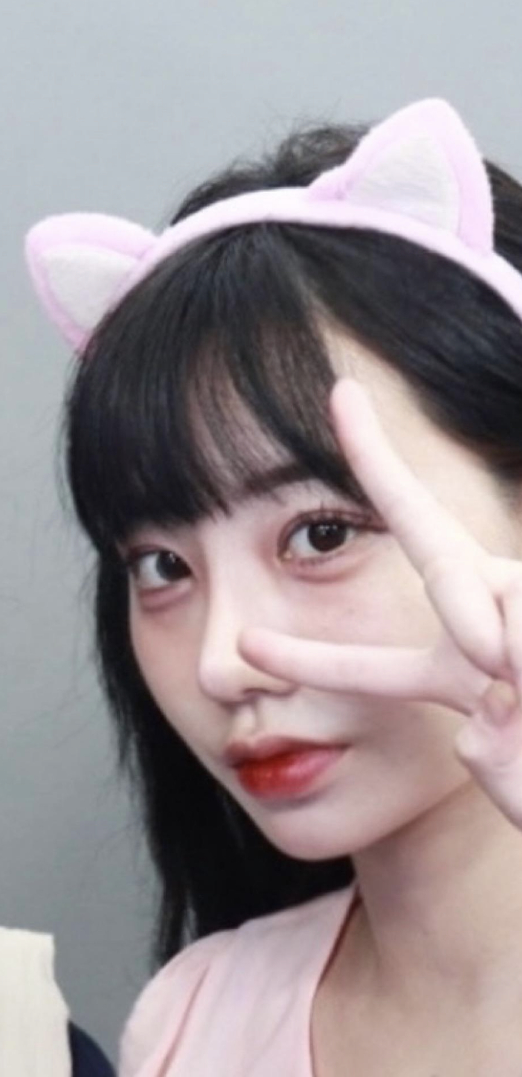 수술후기이미지