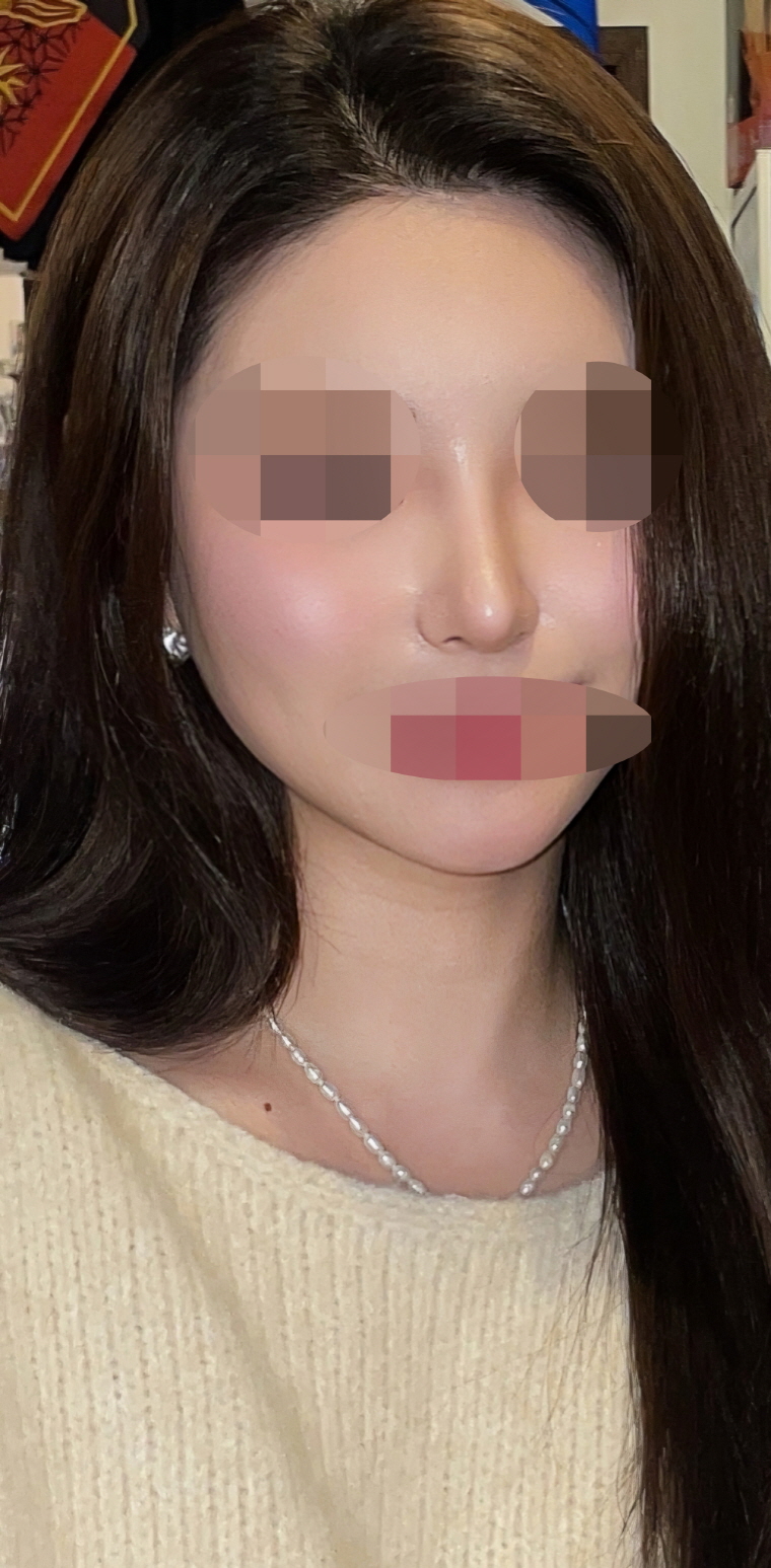 수술후기이미지