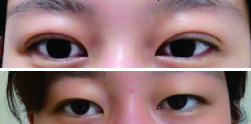 수술후기이미지