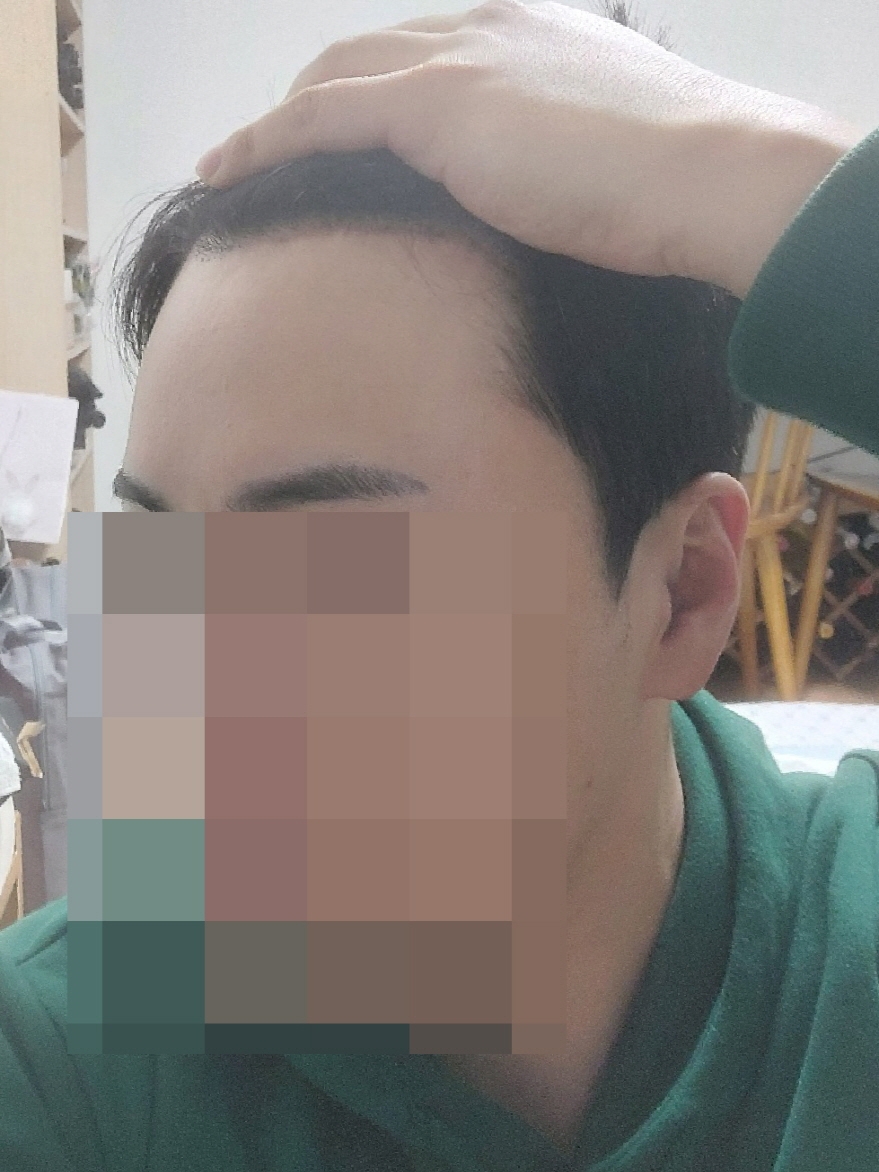 수술후기이미지