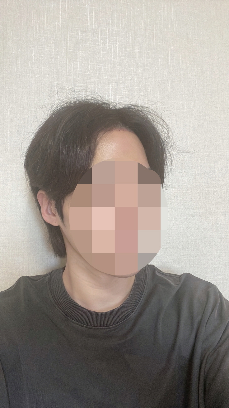 수술후기이미지