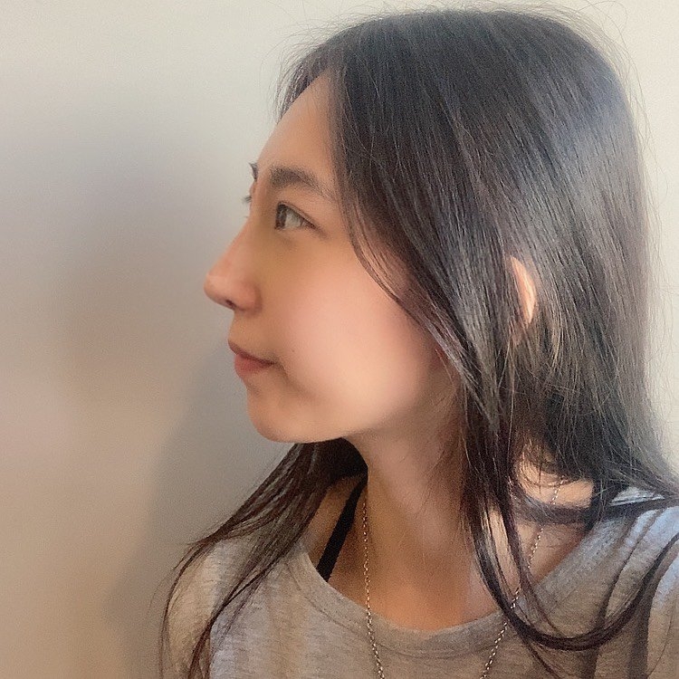 수술후기이미지