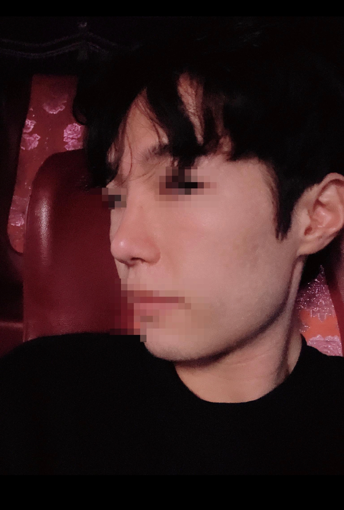 수술후기이미지