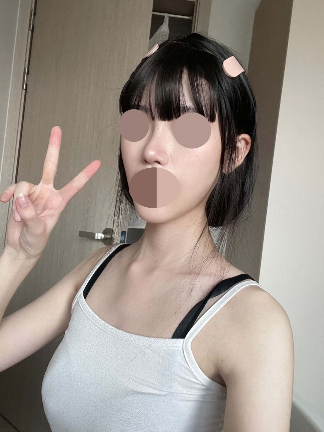 수술후기이미지