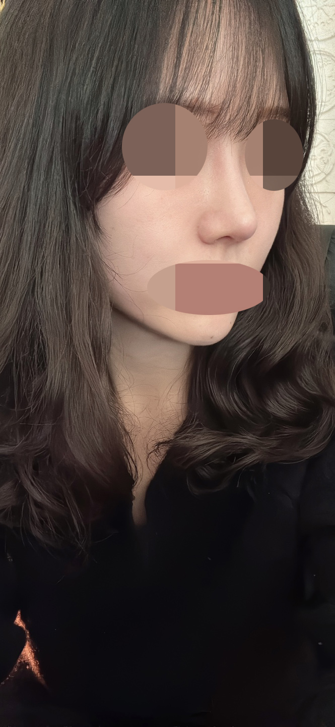 수술후기이미지