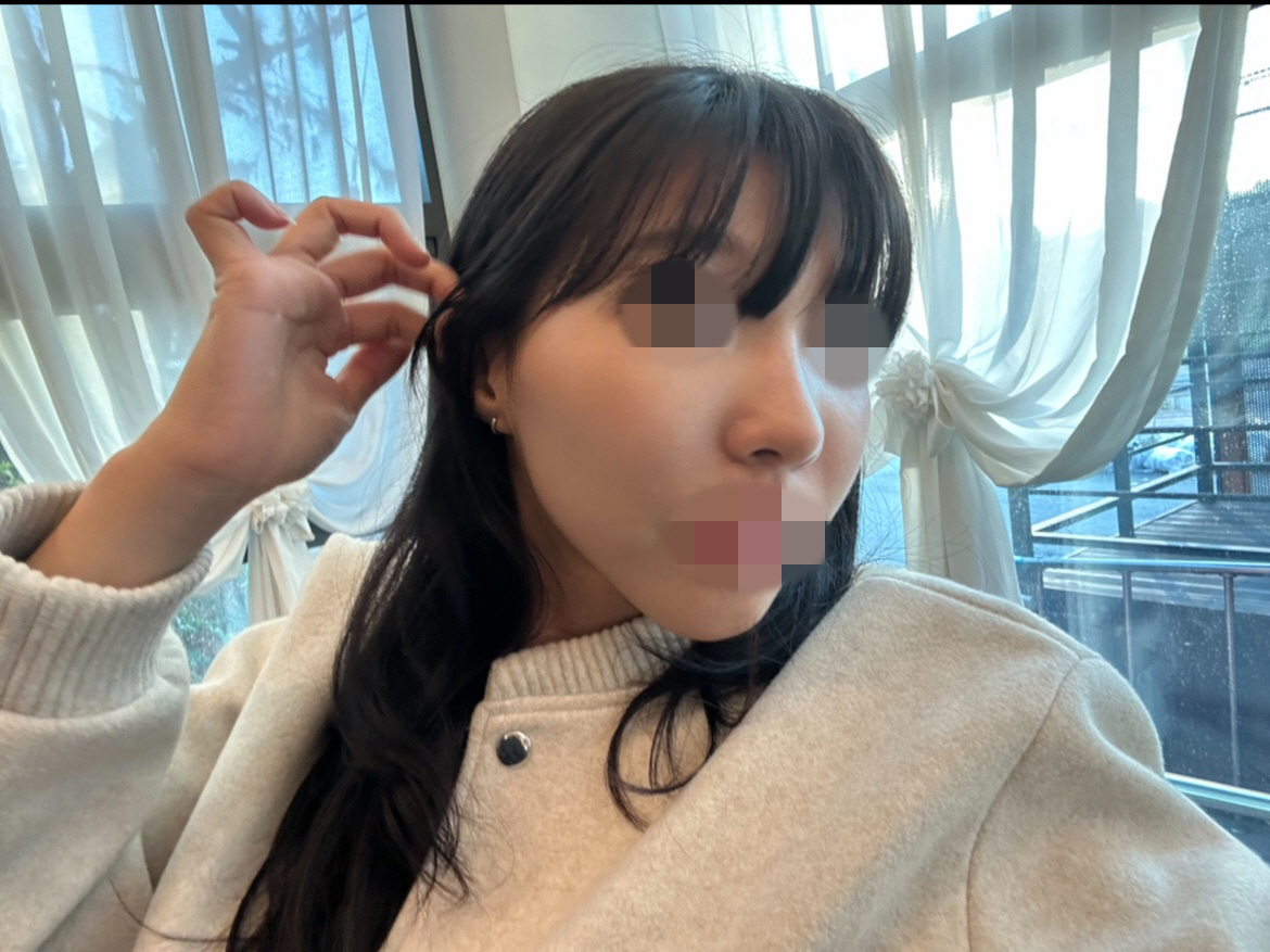 수술후기이미지