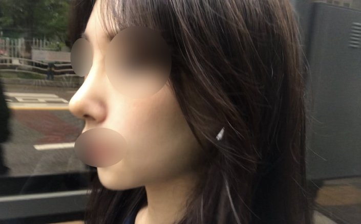 수술후기이미지