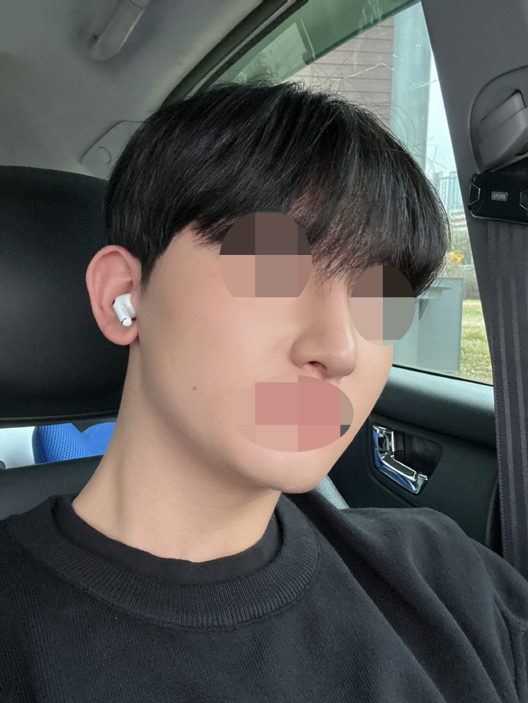 수술후기이미지