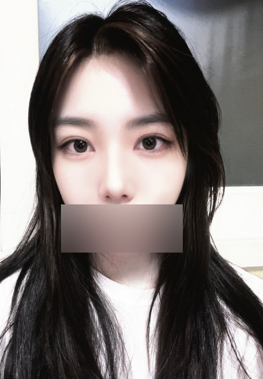 수술후기이미지