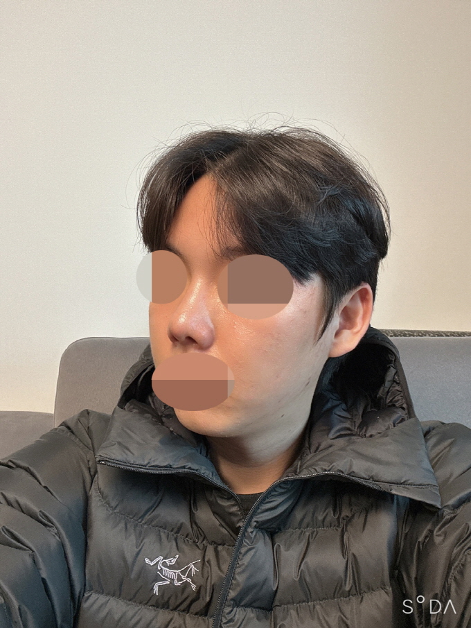 수술후기이미지