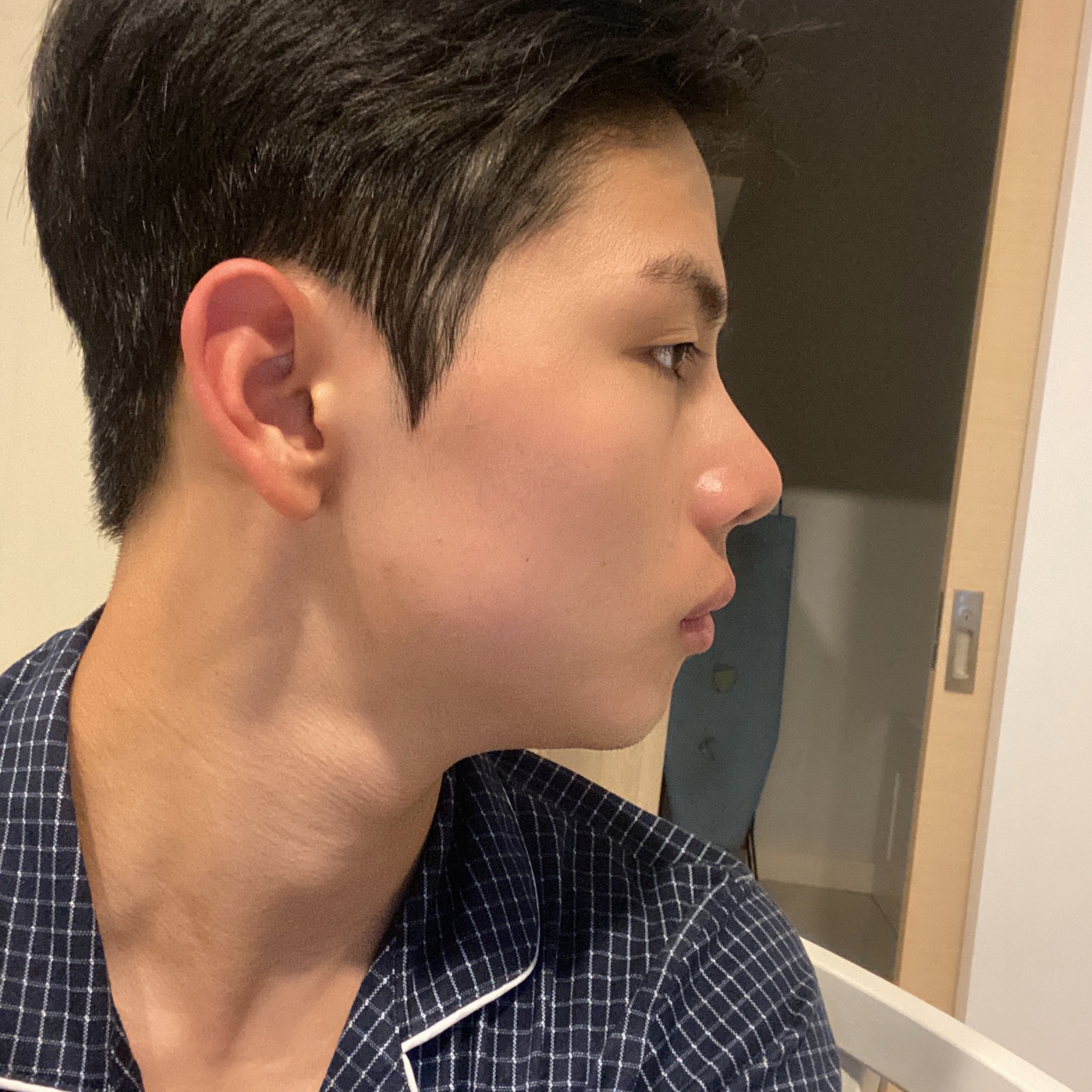 수술후기이미지