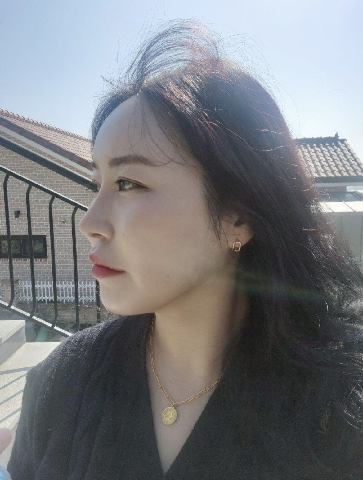 수술후기이미지