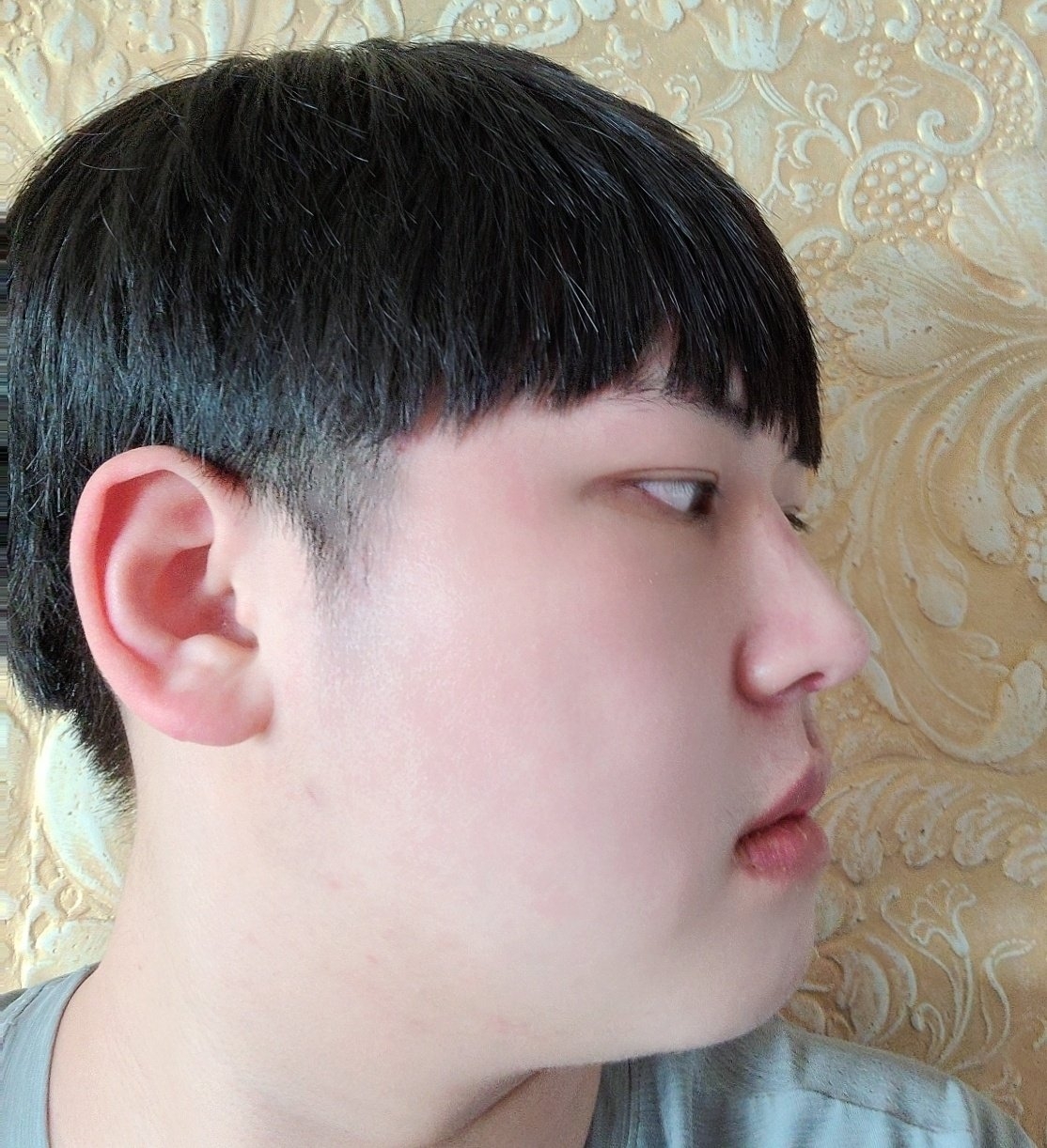 수술후기이미지