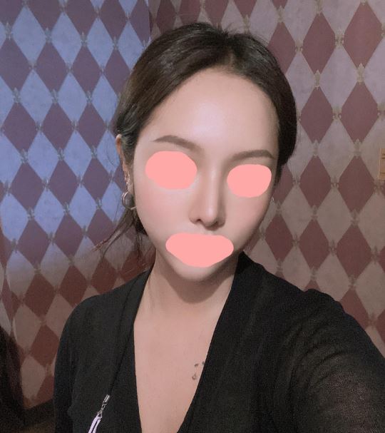 수술후기이미지